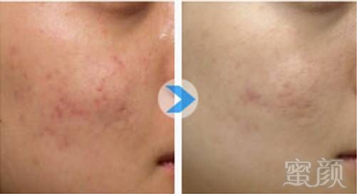 https://img.miyanlife.com/mnt/timg/180113/125J9C54-9.jpg