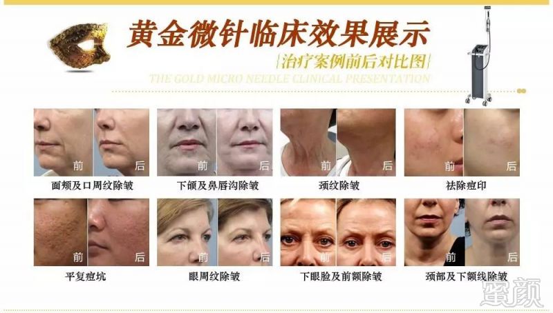https://img.miyanlife.com/mnt/timg/180113/125JS010-3.jpg