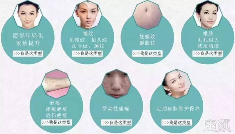 https://img.miyanlife.com/mnt/timg/180113/125JTY7-2.jpg