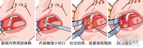 https://img.miyanlife.com/mnt/timg/180113/13015A637-6.jpg