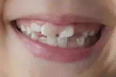 https://img.miyanlife.com/mnt/timg/180113/1333363K3-2.jpg