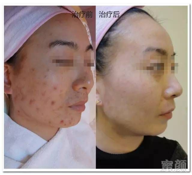 https://img.miyanlife.com/mnt/timg/180113/1336202429-4.jpg