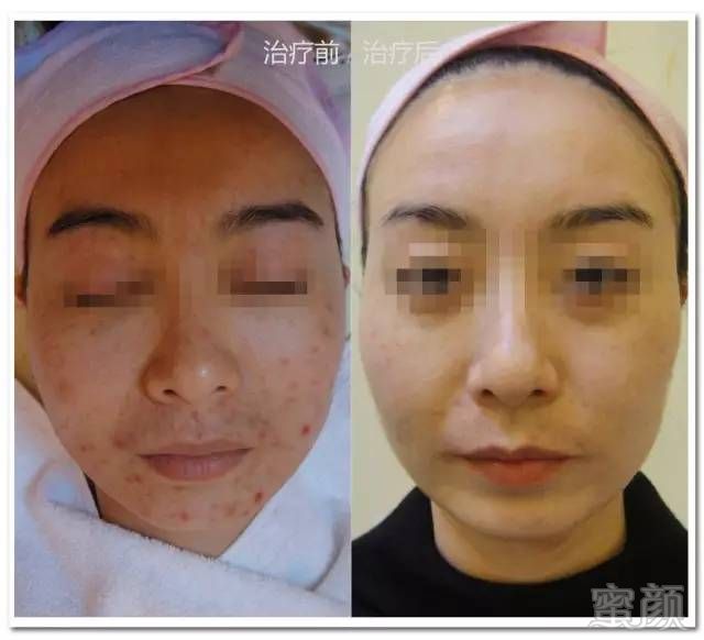 https://img.miyanlife.com/mnt/timg/180113/1336204c6-5.jpg