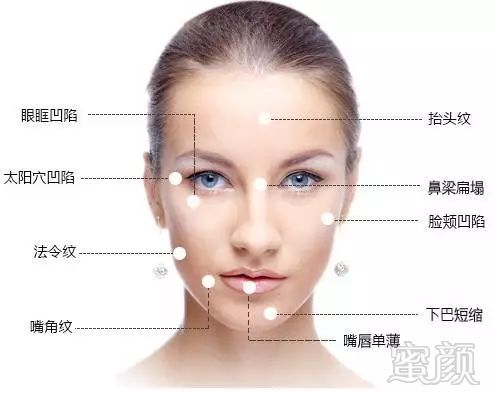 https://img.miyanlife.com/mnt/timg/180114/105455K22-0.jpg