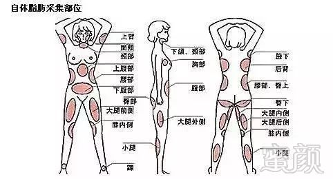 https://img.miyanlife.com/mnt/timg/180114/10545S5Y-10.jpg