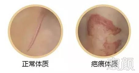 https://img.miyanlife.com/mnt/timg/180114/11041H544-2.jpg
