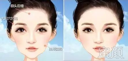 https://img.miyanlife.com/mnt/timg/180114/114133LT-4.jpg