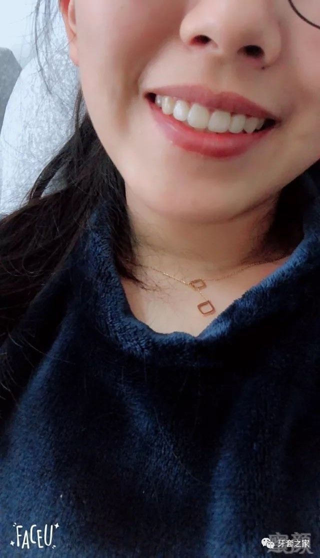 https://img.miyanlife.com/mnt/timg/180114/1144003005-4.jpg