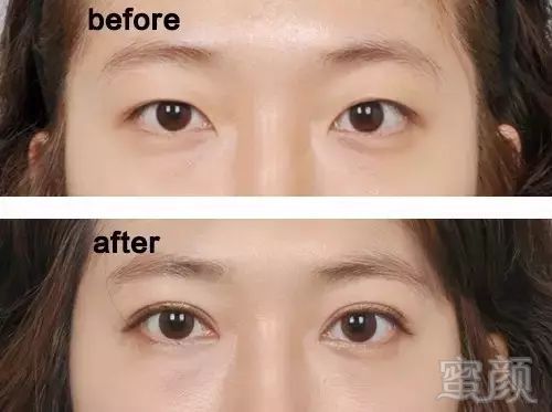 https://img.miyanlife.com/mnt/timg/180114/121609D92-1.jpg