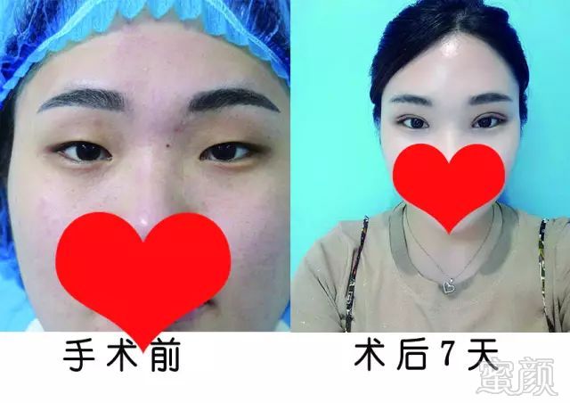 https://img.miyanlife.com/mnt/timg/180114/1216115Z3-5.jpg