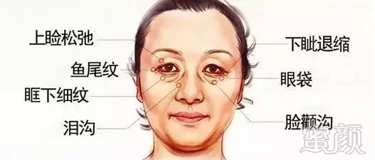 https://img.miyanlife.com/mnt/timg/180114/12391B647-0.jpg