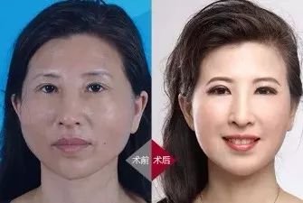 https://img.miyanlife.com/mnt/timg/180114/1300454191-3.jpg
