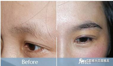 https://img.miyanlife.com/mnt/timg/180115/10200953F-5.jpg