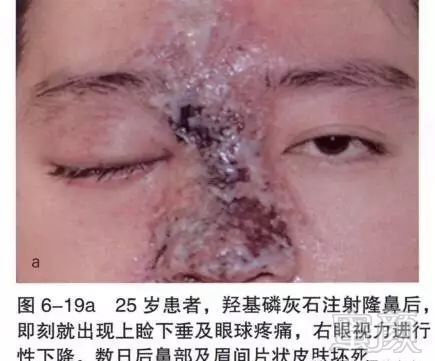 https://img.miyanlife.com/mnt/timg/180115/12124G125-1.jpg