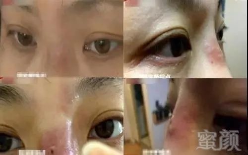 https://img.miyanlife.com/mnt/timg/180115/12124I054-0.jpg