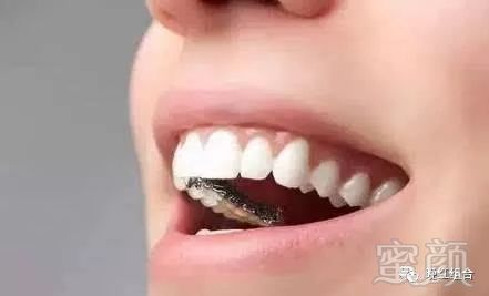 https://img.miyanlife.com/mnt/timg/180115/122GQ4Z-5.jpg