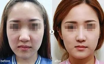 https://img.miyanlife.com/mnt/timg/180115/122UI9E-9.jpg