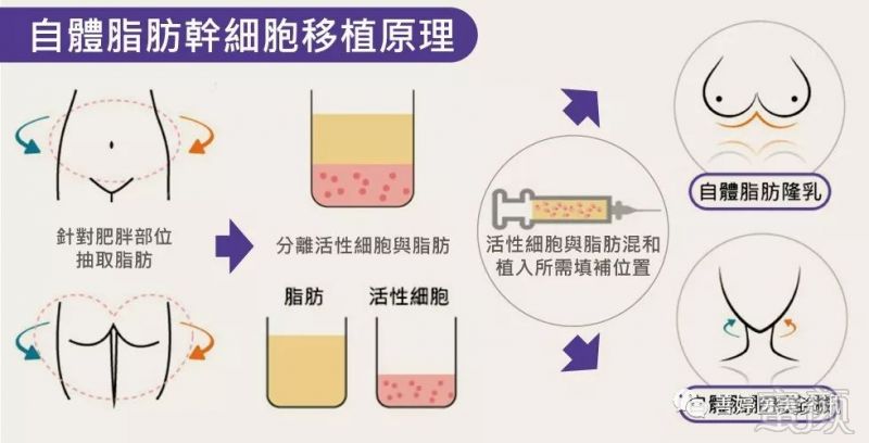 https://img.miyanlife.com/mnt/timg/180115/12410S442-2.jpg