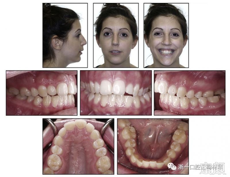 https://img.miyanlife.com/mnt/timg/180116/105J24049-0.jpg