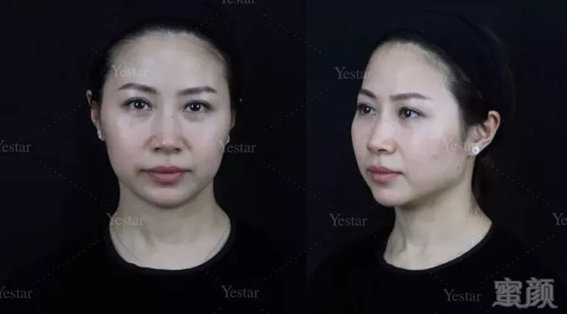 https://img.miyanlife.com/mnt/timg/180116/1104294245-5.jpg