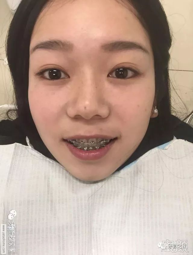 https://img.miyanlife.com/mnt/timg/180116/1210222Q4-5.jpg
