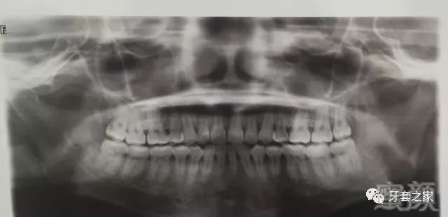 https://img.miyanlife.com/mnt/timg/180116/121023H52-7.jpg
