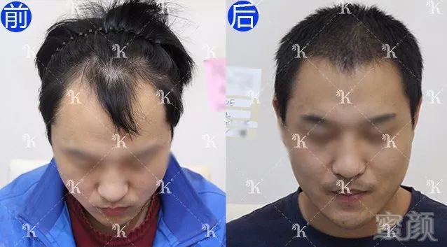 https://img.miyanlife.com/mnt/timg/180116/12193045L-0.jpg