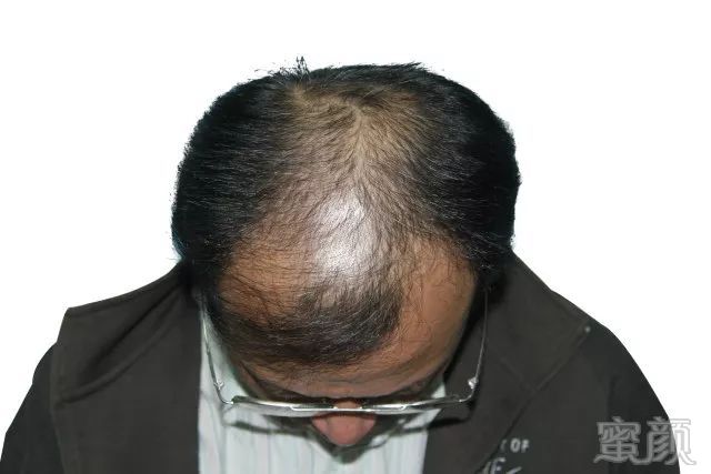 https://img.miyanlife.com/mnt/timg/180116/12355W261-1.jpg