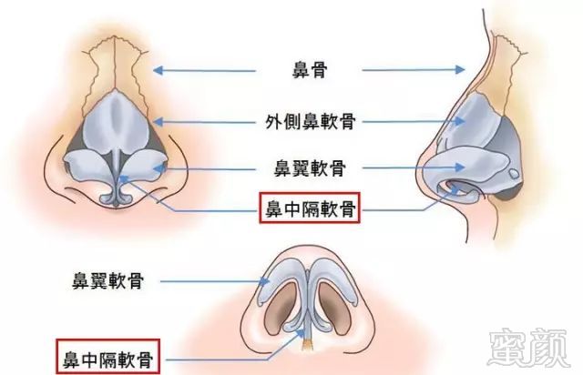 案例图片