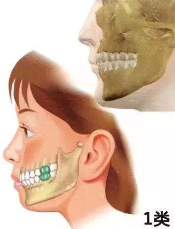 https://img.miyanlife.com/mnt/timg/180116/1242004053-2.jpg