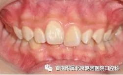 https://img.miyanlife.com/mnt/timg/180116/12440GL7-2.jpg