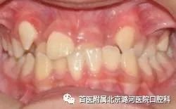 https://img.miyanlife.com/mnt/timg/180116/12440GS8-1.jpg