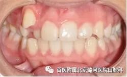 https://img.miyanlife.com/mnt/timg/180116/12440I301-4.jpg