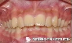 https://img.miyanlife.com/mnt/timg/180116/12440MD3-3.jpg