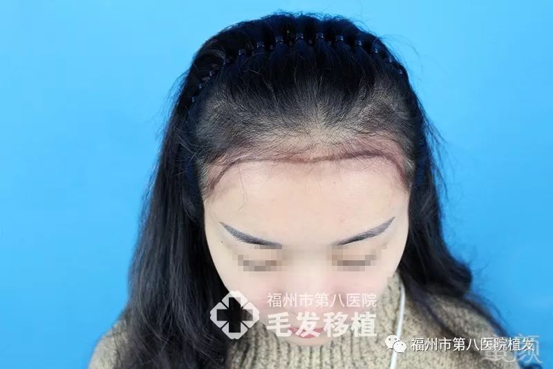 https://img.miyanlife.com/mnt/timg/180116/124A51131-2.jpg
