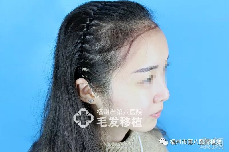 https://img.miyanlife.com/mnt/timg/180116/124A563c-3.jpg