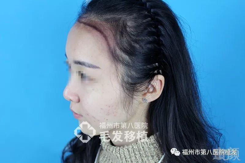 https://img.miyanlife.com/mnt/timg/180116/124A621H-4.jpg