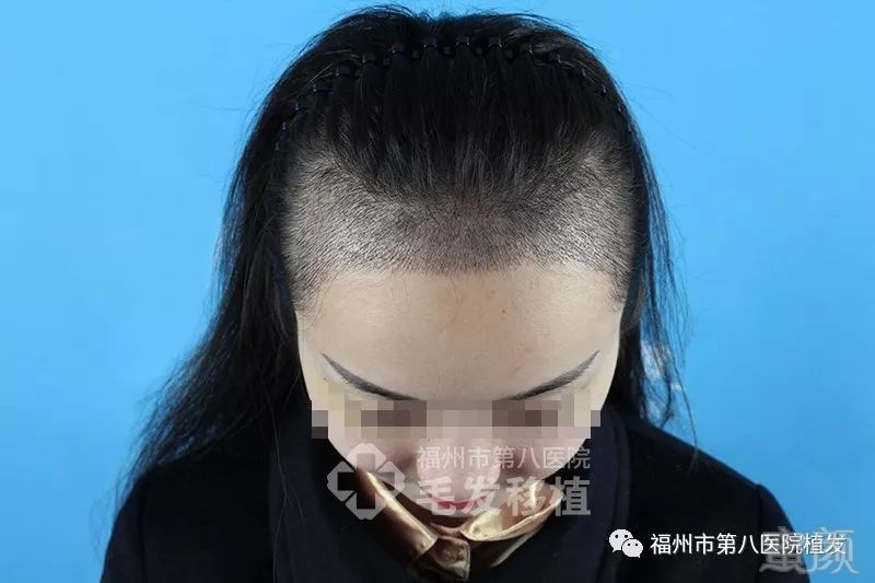 https://img.miyanlife.com/mnt/timg/180116/124AAa9-6.jpg