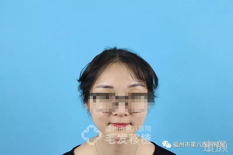 https://img.miyanlife.com/mnt/timg/180116/124AK550-8.jpg