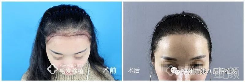 https://img.miyanlife.com/mnt/timg/180116/124AT4J-10.jpg