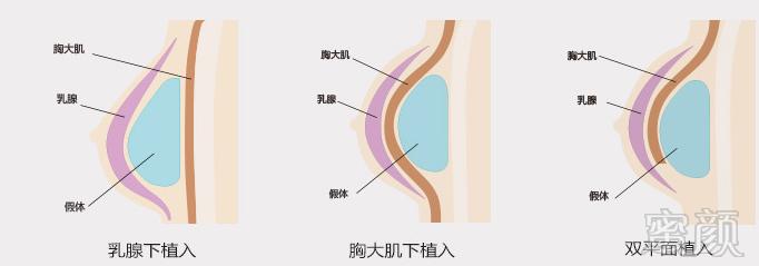 案例图片