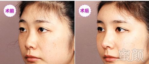 https://img.miyanlife.com/mnt/timg/180117/1135063F9-2.jpg