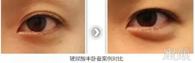 https://img.miyanlife.com/mnt/timg/180117/11350IA0-8.jpg