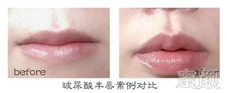 https://img.miyanlife.com/mnt/timg/180117/11350K013-7.jpg