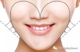 https://img.miyanlife.com/mnt/timg/180117/1141493612-6.jpg