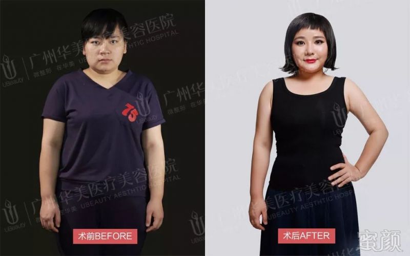 https://img.miyanlife.com/mnt/timg/180117/1151214M5-4.jpg
