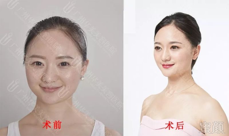 https://img.miyanlife.com/mnt/timg/180117/11512244b-6.jpg