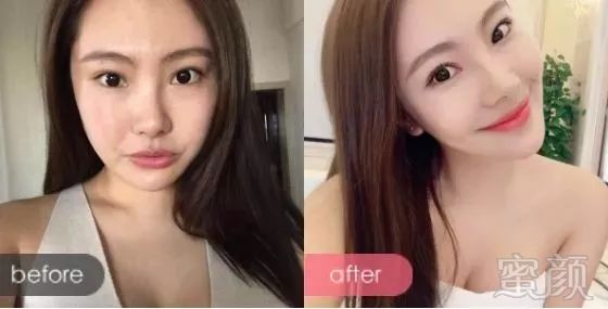 https://img.miyanlife.com/mnt/timg/180117/1214254J8-11.jpg