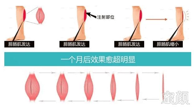 https://img.miyanlife.com/mnt/timg/180117/1226345952-5.jpg