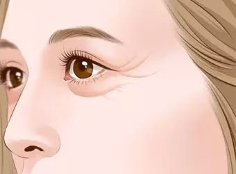 https://img.miyanlife.com/mnt/timg/180117/12364R158-0.jpg